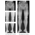 Radiographie numérique haute fréquence et équipement de fluoroscopie Dynamique 630